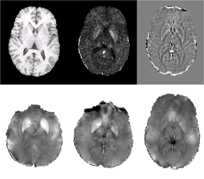 File:Fig2 compound lighter.png