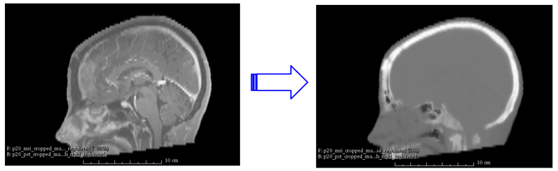 File:MRI2CT.png