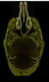 Registered mCT scans.png