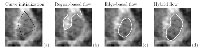 File:Lankton Putamen.PNG