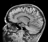 this is the fixed reference image. All images are aligned into this space