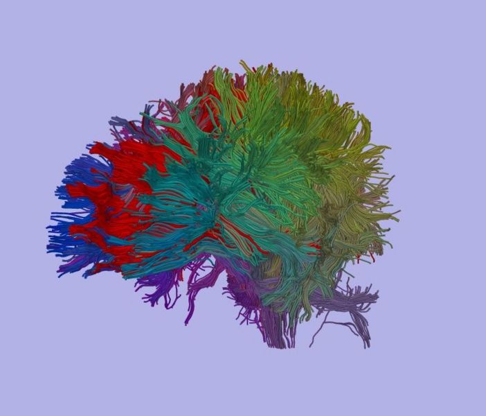 File:Clustering brain.jpg