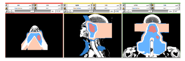 Isodose lines in Slicer 3
