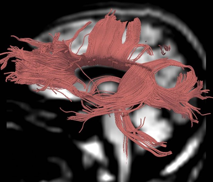 File:CaseD00724 L blur20.jpg