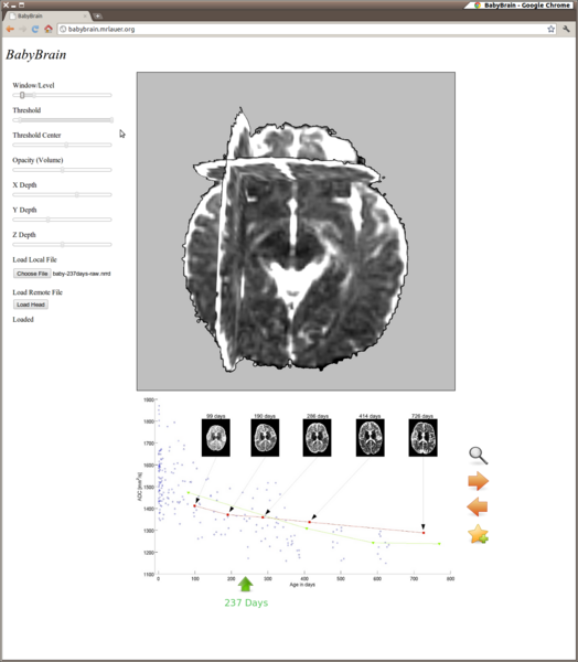 File:BabyBrain-mockup1.png