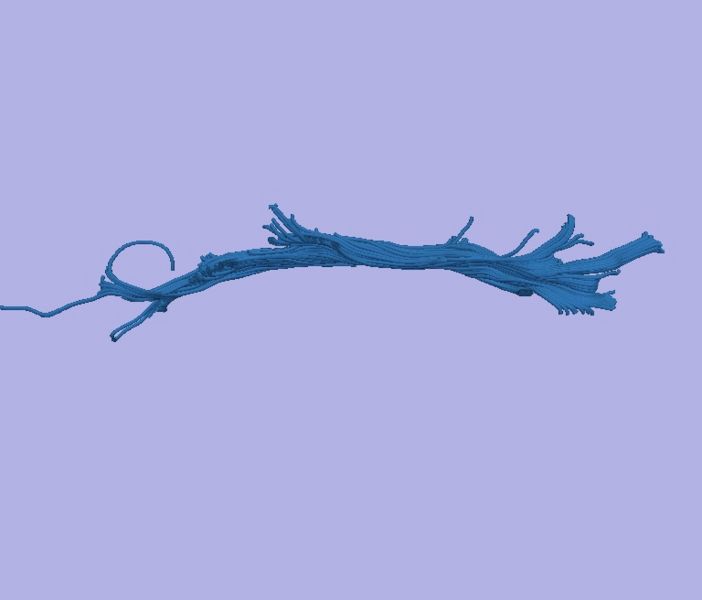 File:CaseD0688 L dil0 sens40.jpg