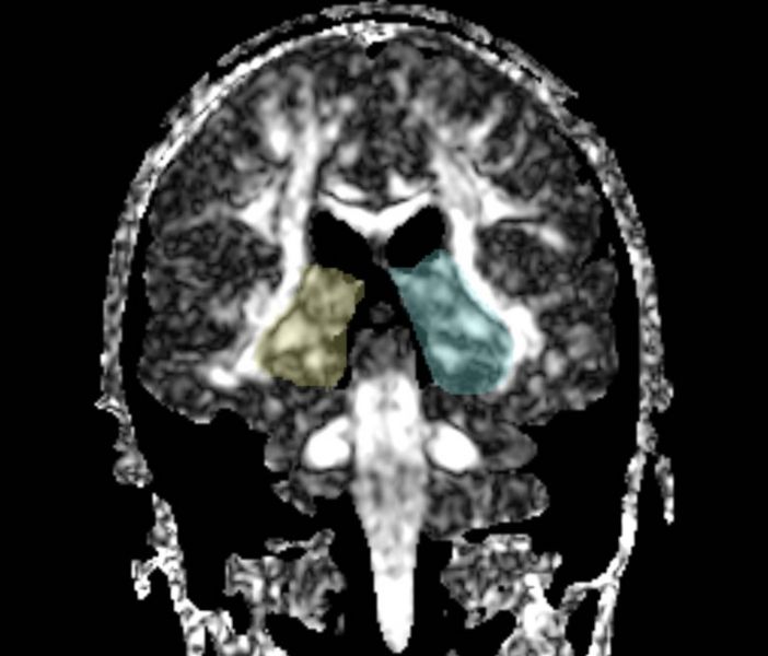 File:Fornix roi2.jpg