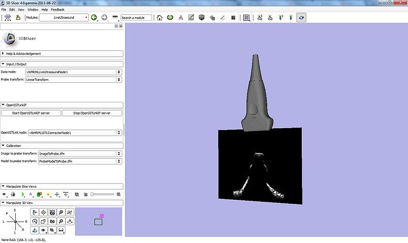 File:LiveUltrasoundModule-Slicer4.jpg