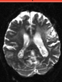 this is the moving image. The transform is calculated by matching this to the reference image