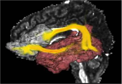 FIG.2-9.arcuate.png