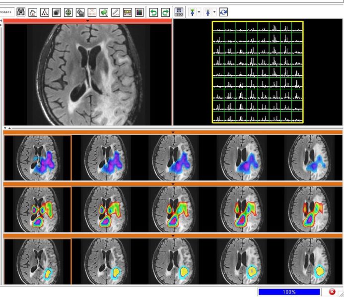 File:Sivic slicer slc2.tif
