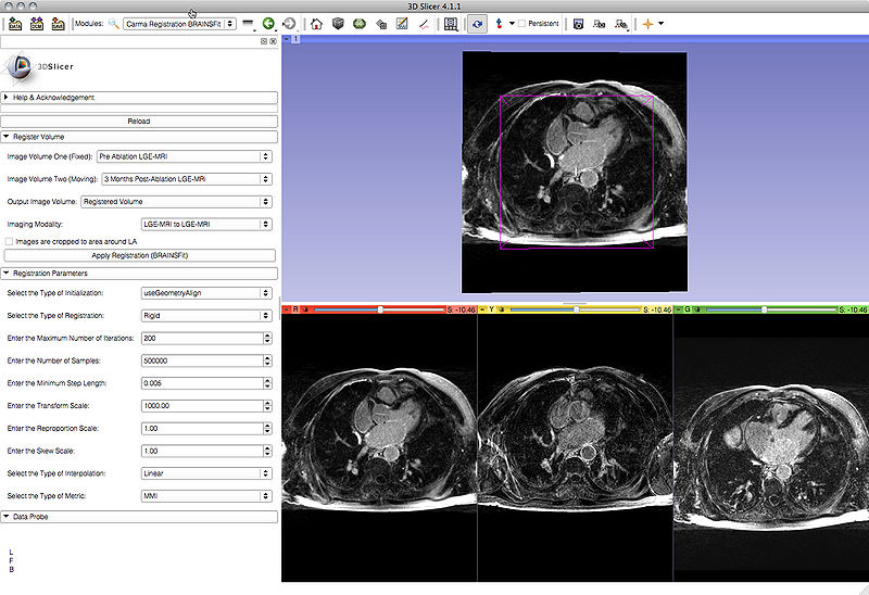 File:Slicer Carma BrainsFit Screenshot.jpg