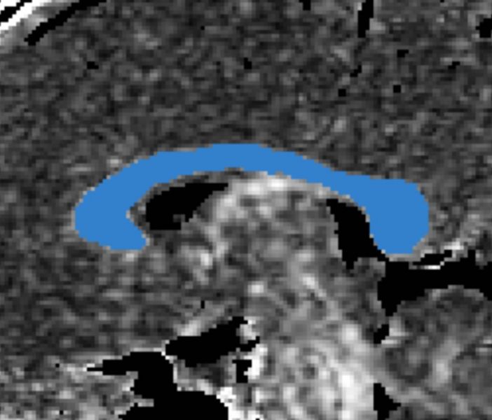 File:CaseD20 newROI0001.jpg