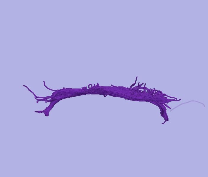 File:CaseD00724 L dil7 sens40.jpg