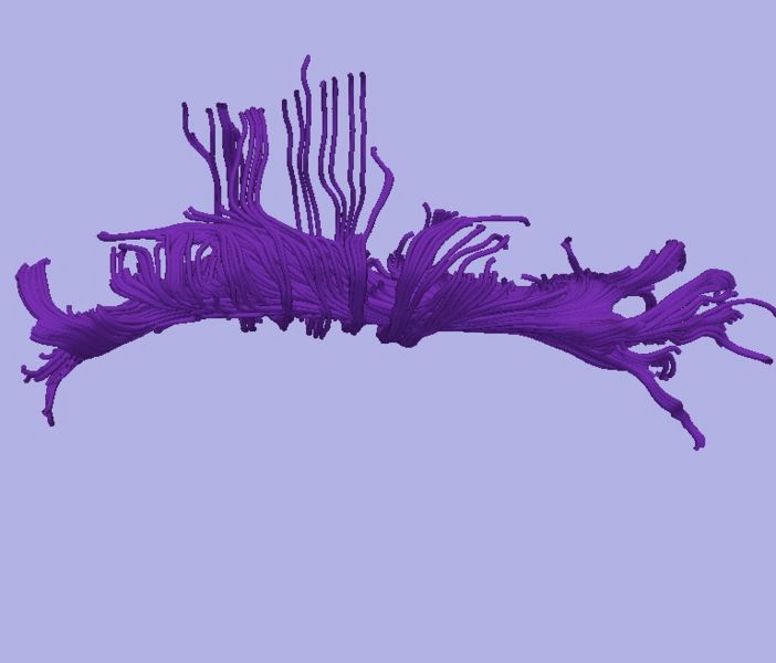 File:CaseD0608 L dil7 sens1.jpg