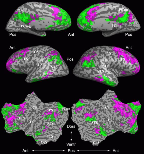 File:Mit fmri clustering intrinsicsystem.png