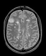 this is the fixed reference image. All images are aligned into this space