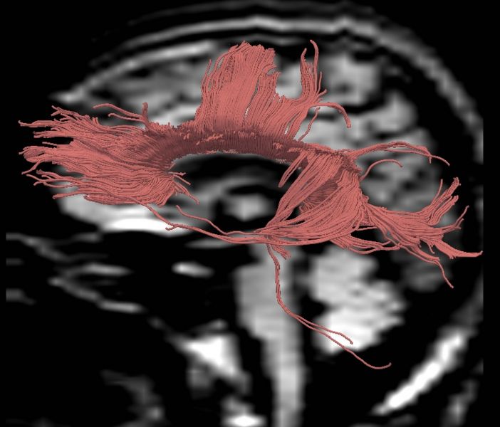 File:CaseD00724 L blur0.jpg