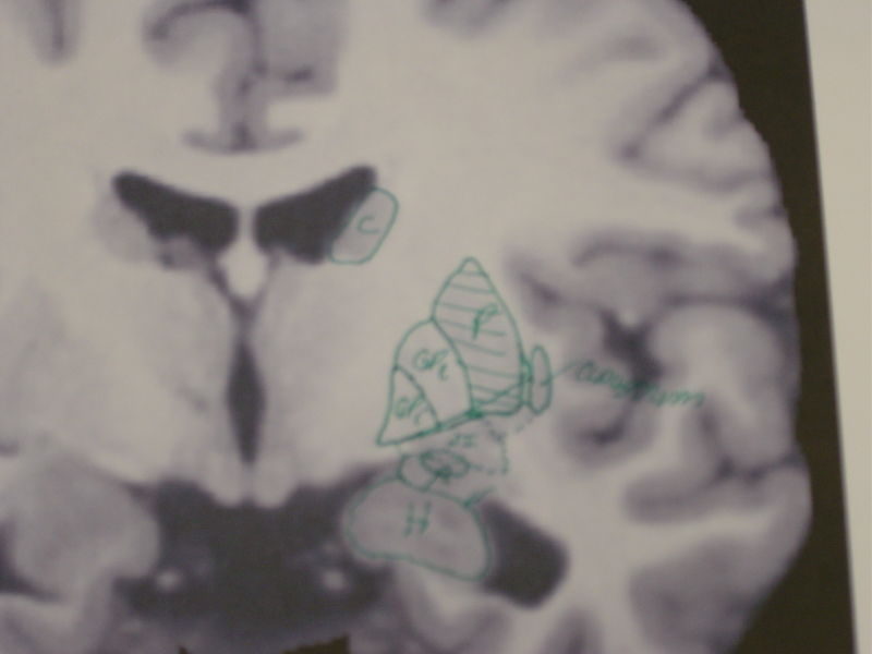 File:Gatech 121705 DSC06150.JPG