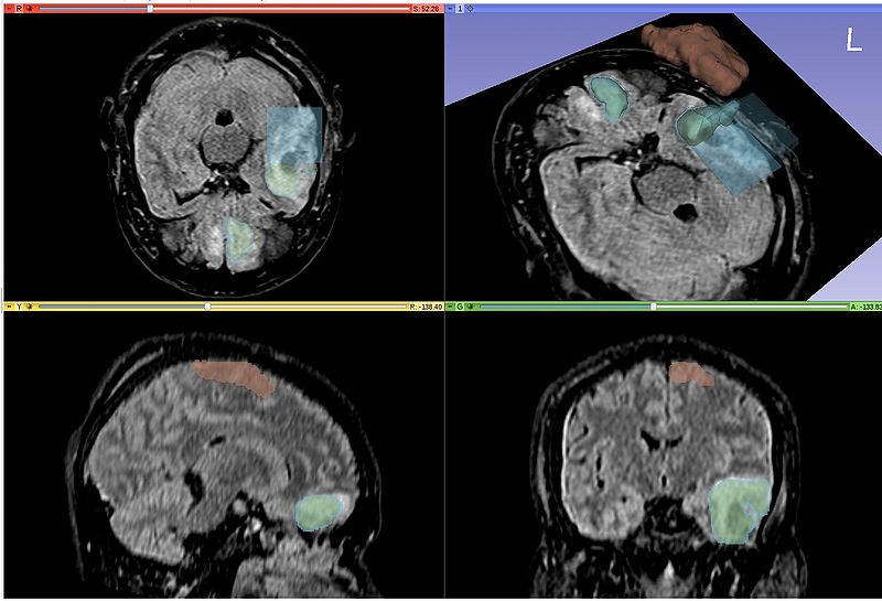 File:AcSeg activelearning.jpg