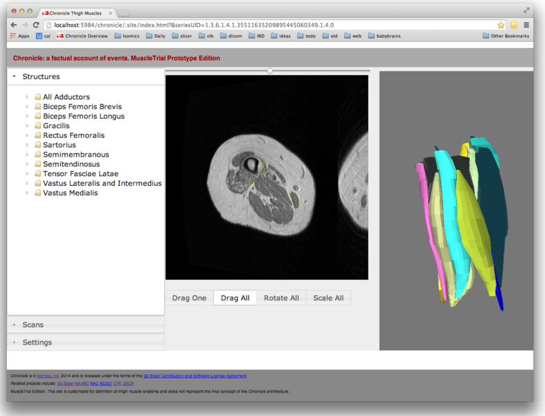 File:Chronicle-muscles 2-2014-05-22.png