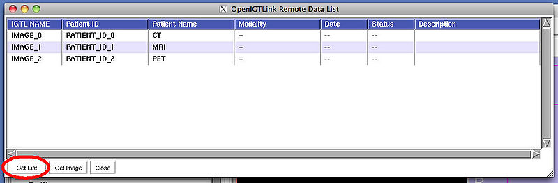 File:OpenIGTLink ProtocolV2 RemoteDataList3.jpg