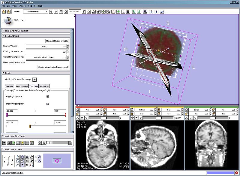 File:Slicer3 3DWidget2.jpg