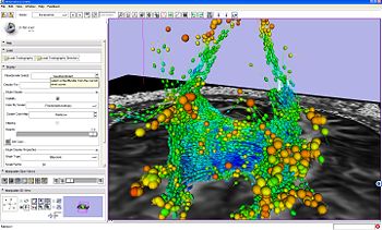 Tractography fiber bundles displayed as lines and glyph ellipsoids