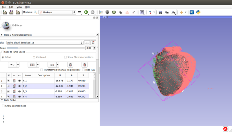 File:Rigid registration.png