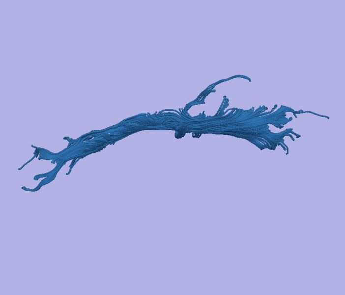 File:CaseD116 L dil0 sens20.jpg