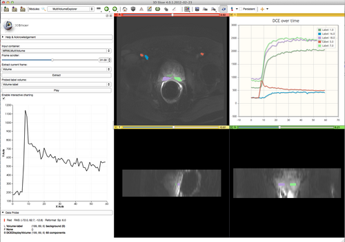 Slicer 4 1 MultiVolumeCharts.png