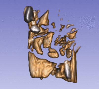 Wrist volume rendering small.gif