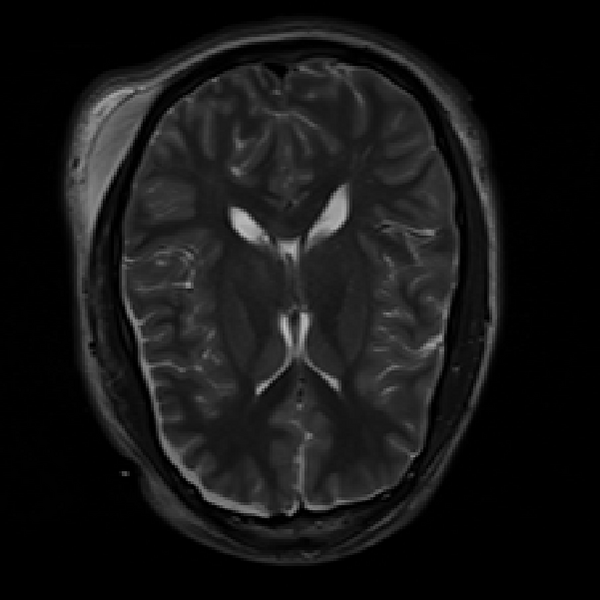 File:MRI sample subject.png