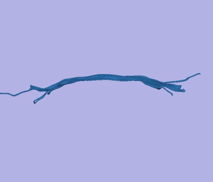 File:CaseD0688 L dil0 sens100.jpg