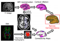 CorticalCorrespondenceConnectivityIPMI scheme.png