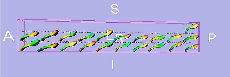 File:ShapeAnalysisModule phi mrml.jpg