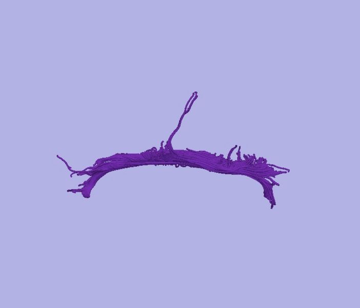 File:CaseD00724 L dil3 sens20.jpg