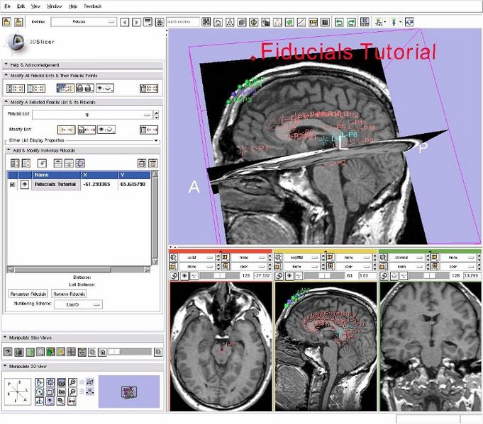 File:Fiducials TutorialContestSummer2010.jpg