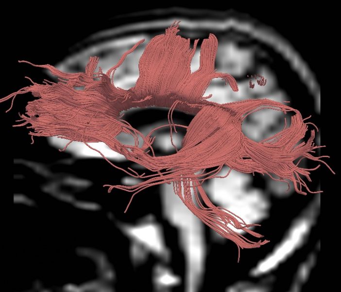 File:CaseD00724 L blur15.jpg