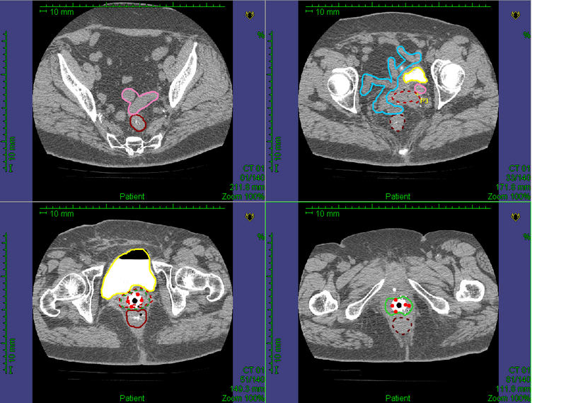 File:Gyne Structures.png