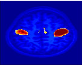 Mit fmri clustering Seed M1.jpeg