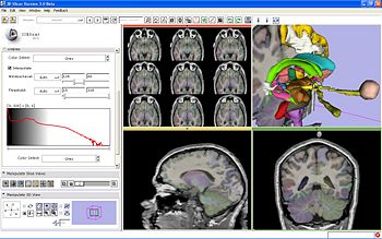 Visualization of the SPL/PNL Brain Atlas