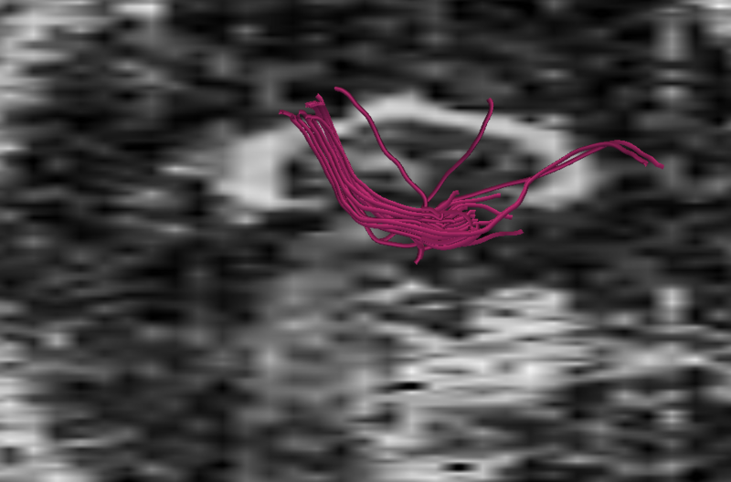 File:Kulee arcuate-17x17x5 case19.png