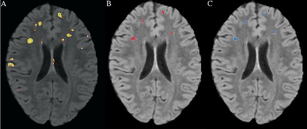 Scully-FrontHumNeurosci2010-fig3.jpeg