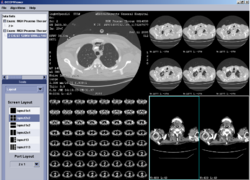 DICOMViewer Layouts.png