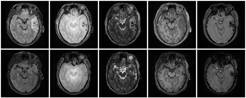 File:Multimodal TBI.png