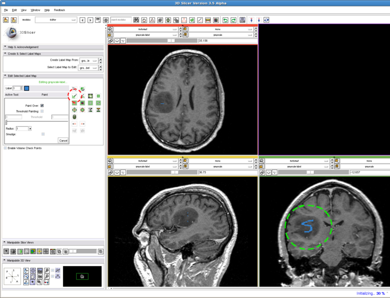 File:RSS editStep.png