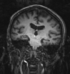 RegLib 14: coronal MRI