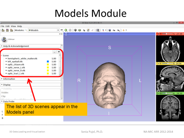 Slicer 4.2 Data Loading and 3D Visualization slide27.png