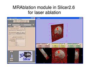 Slicer igt img5.jpg